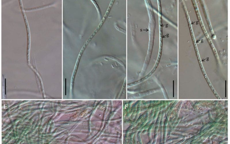 Microscopio biológico Cartusia hunanesis sp. nov. Oculatellaceae, Oculatellales de un arroyo de China según un enfoque polifásico